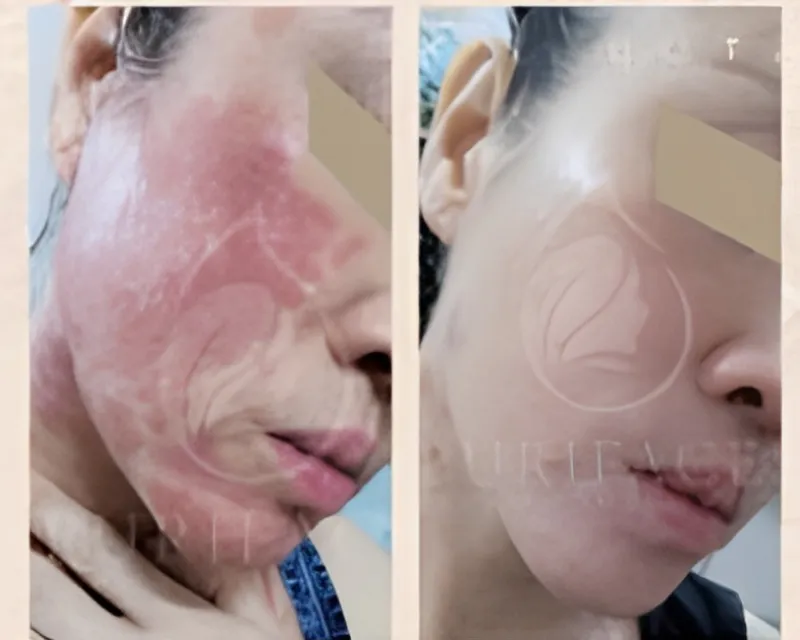 Before After 1