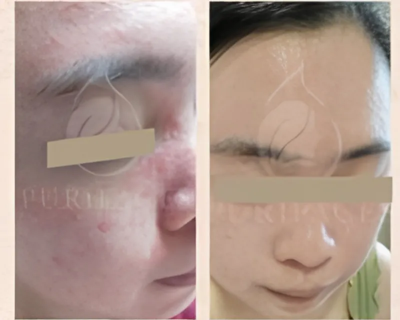 Before After 2