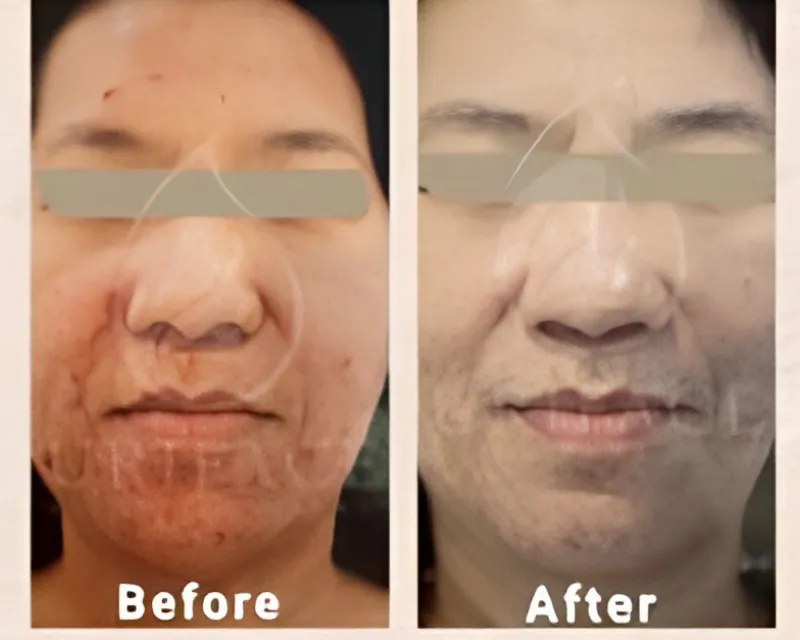 Before After 1