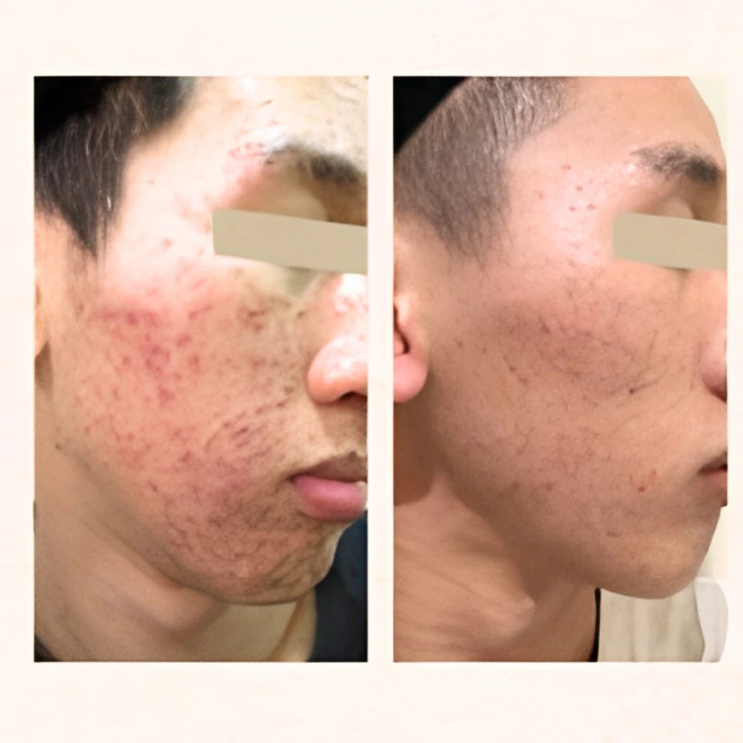 顾客护理前后对比 8
